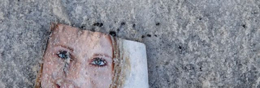 La caissière et son psoriasis