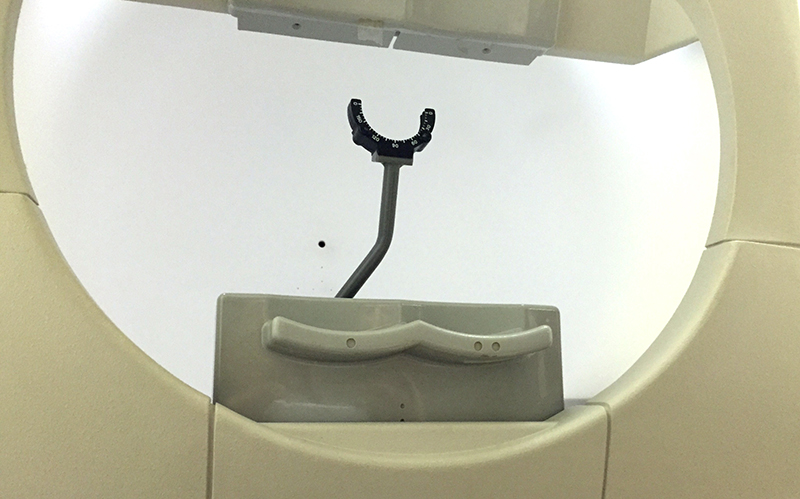 Éclatement du vitré